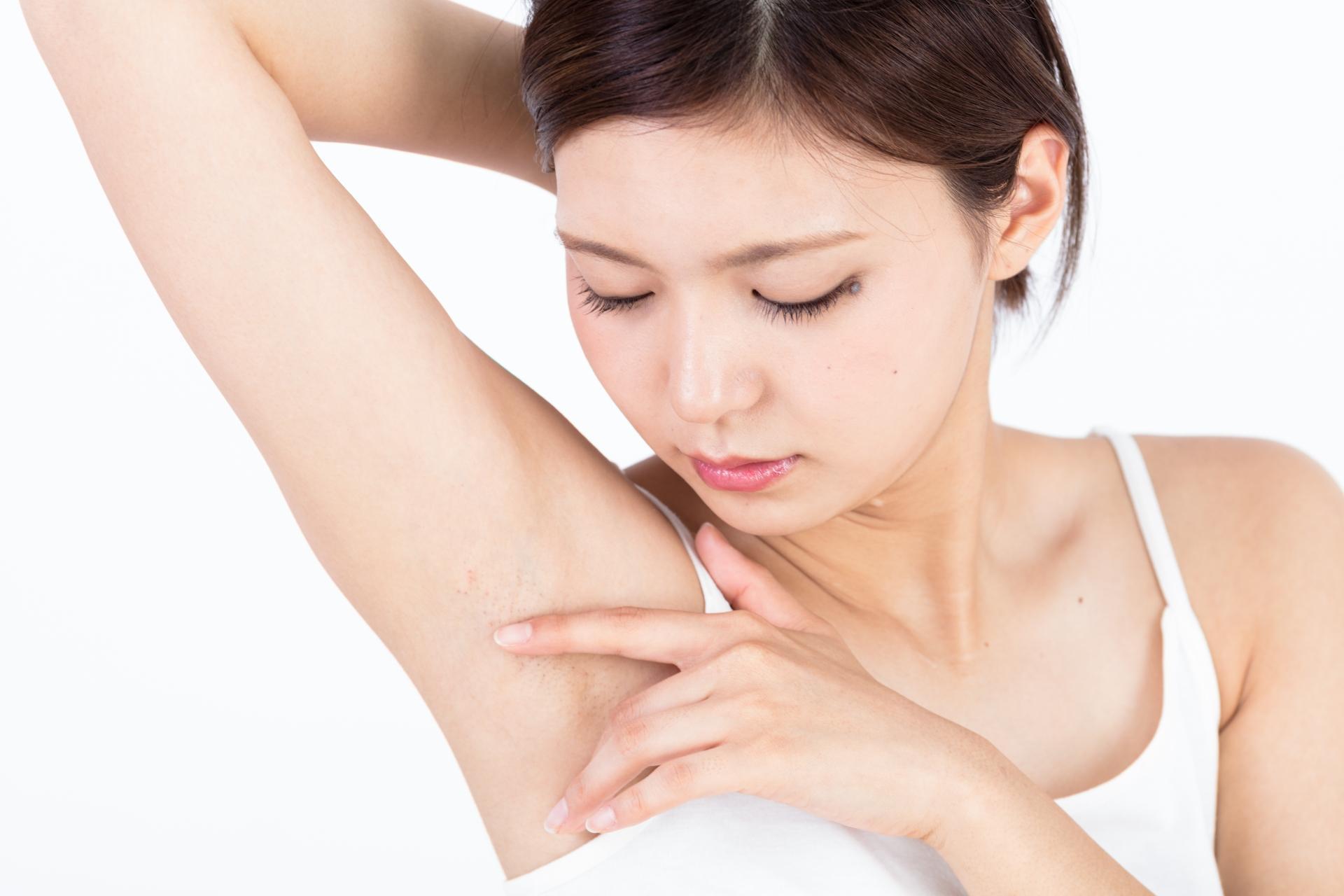 ワキガの原因を徹底解説！多汗症との違いや改善方法も紹介