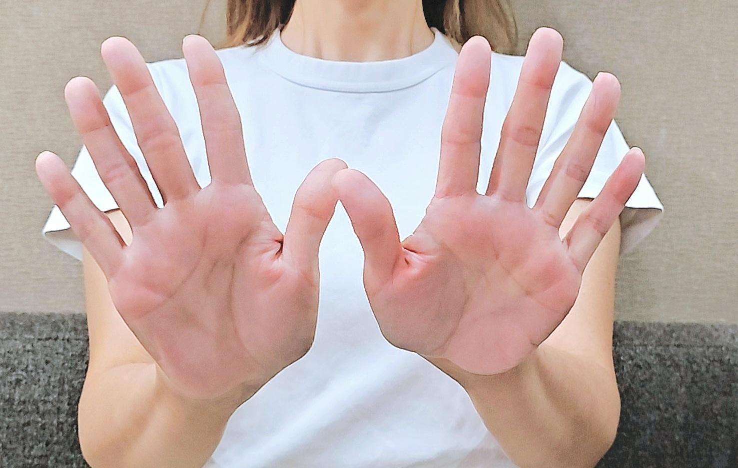 手汗の治療について徹底解説！手掌多汗症を改善する薬や処置方法を紹介