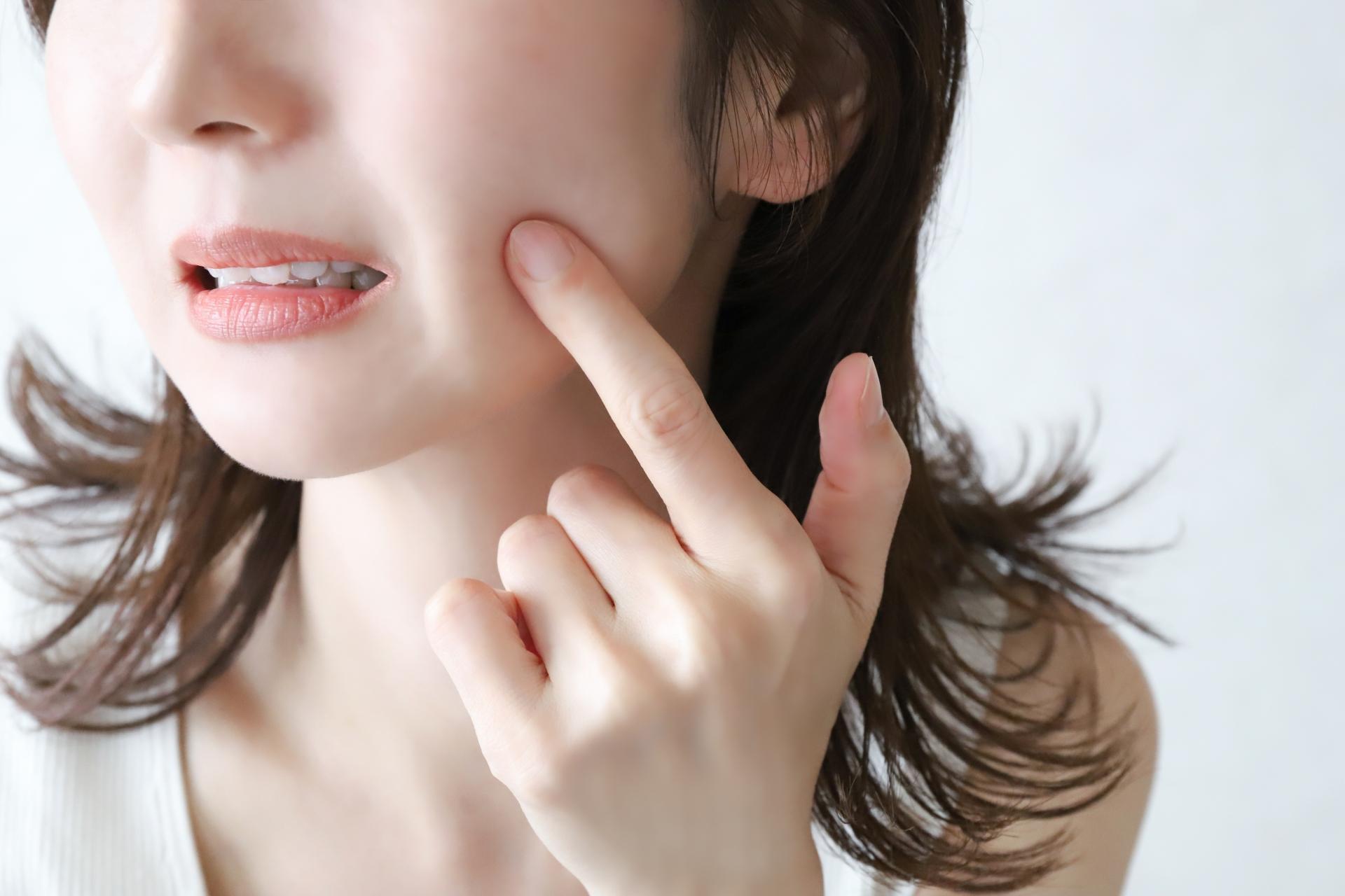 トラネキサム酸はニキビに効く？期待できる効果やニキビ跡・色素沈着への作用を解説