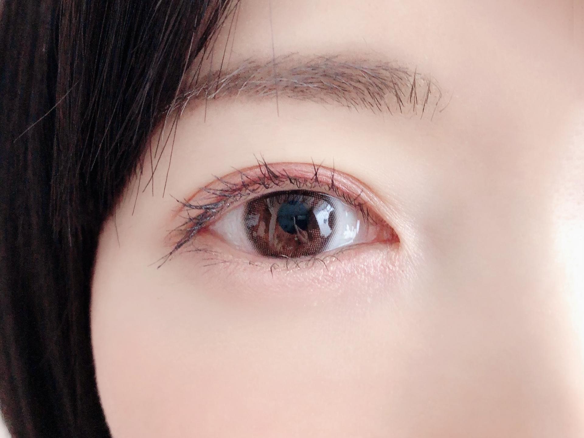 眼瞼下垂を手術しないで治す方法はある?マッサージ・テープ・点眼薬の効果を紹介