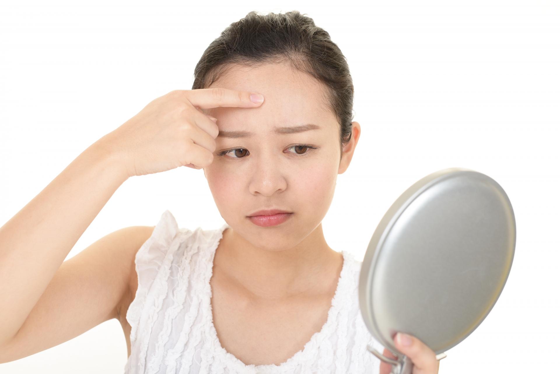 おでこニキビができる理由とは？原因と治し方、繰り返さないための対策を解説