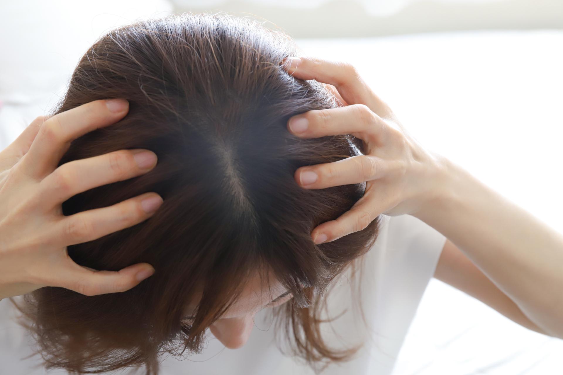 女性の頭頂部の薄毛の原因とは？セルフケアと治療薬による対策を解説